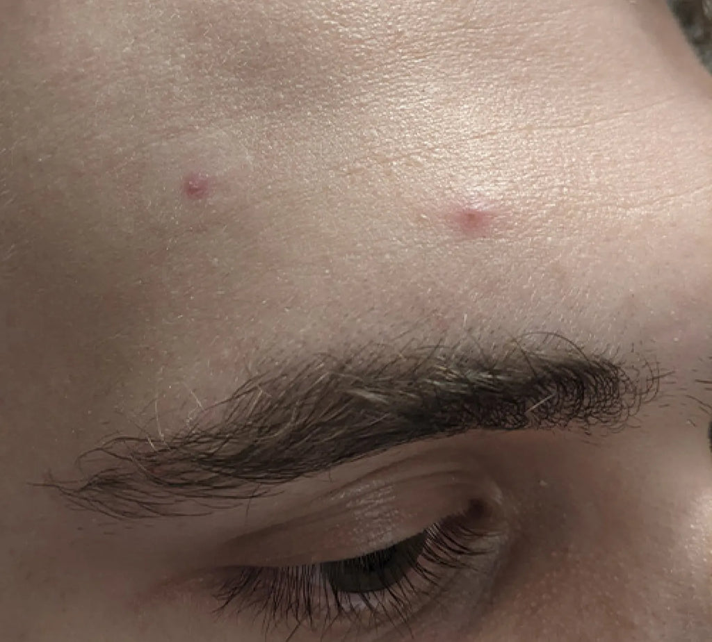 PanOxyl 抗痘控油 淨膚泡沫潔面乳 156g
