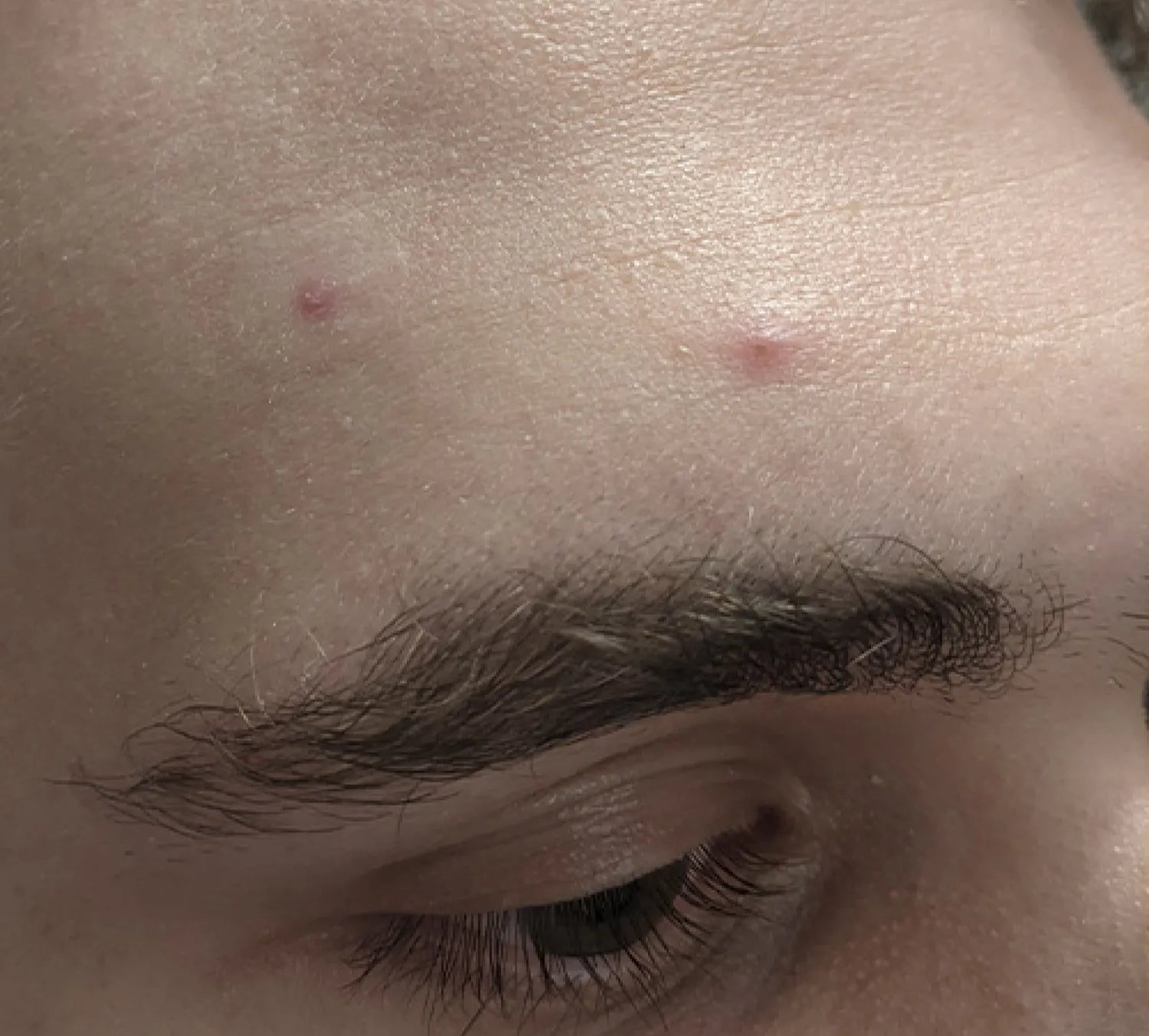 PanOxyl 抗痘控油 淨膚泡沫潔面乳 156g
