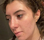 PanOxyl Acne Foaming Wash Benzoyl Peroxide 10% 156g