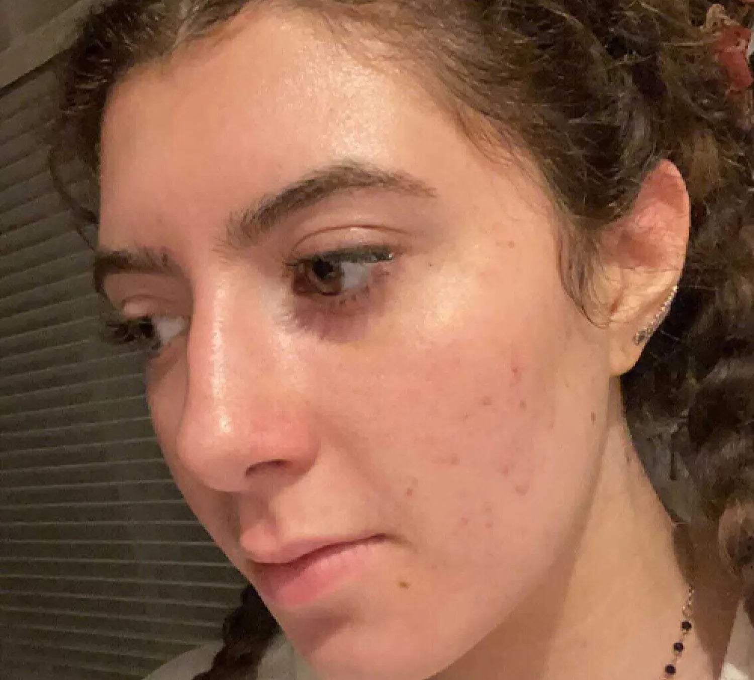 PanOxyl 抗痘控油 淨膚泡沫潔面乳 156g
