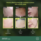 ANUA 韓國 77%魚腥草 舒緩鎮靜保濕爽膚水 250ml