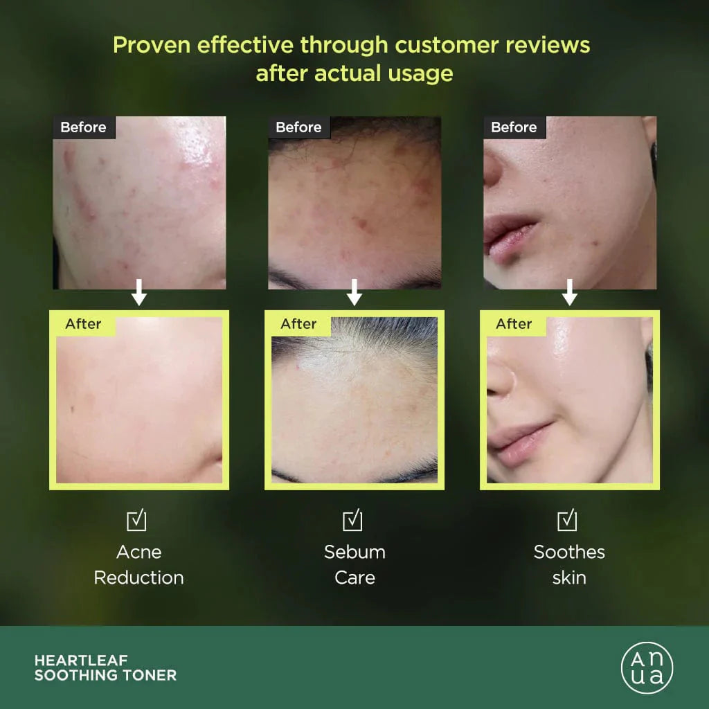 ANUA 韓國 77%魚腥草 舒緩鎮靜保濕爽膚水 250ml