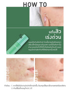 Baby Bright 2% Salicylic Acid Clear Acne Clearing Gel 15g