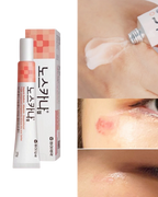 Gel cicatrisant Dong-A Pharm Noscarna, grand format (traitement des cicatrices chéloïdes, chirurgicales et d'acné), 20 g