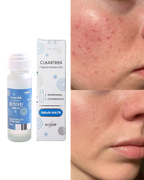 Handok 韓國 2%水楊酸暗瘡祛痘液 30ml