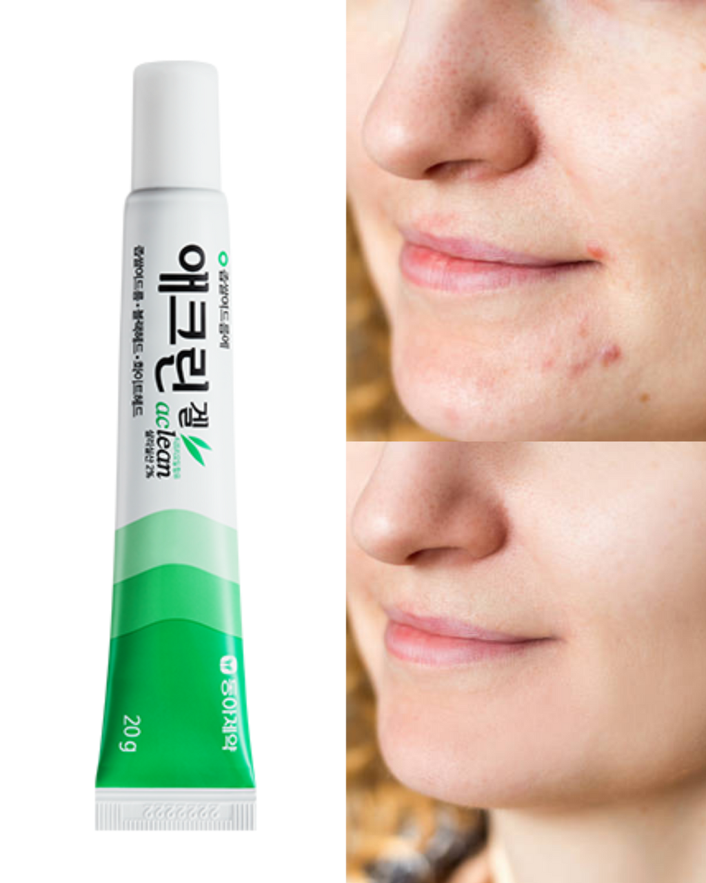 Dong-A Pharm Aclean Gel 20g