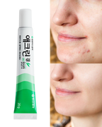 Dong-A Pharm Aclean Gel 20g