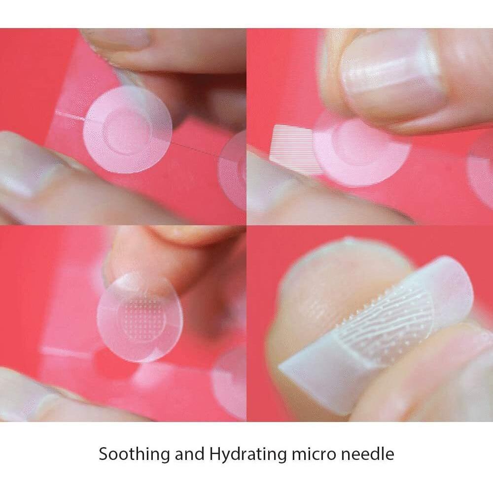 CURESYS Trouble Clear Needle Patch (14mm) 9ea