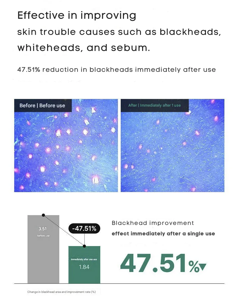 Dong-A Pharm Tranexamic Acid B3 Pigmentation Pro Cream 40ml