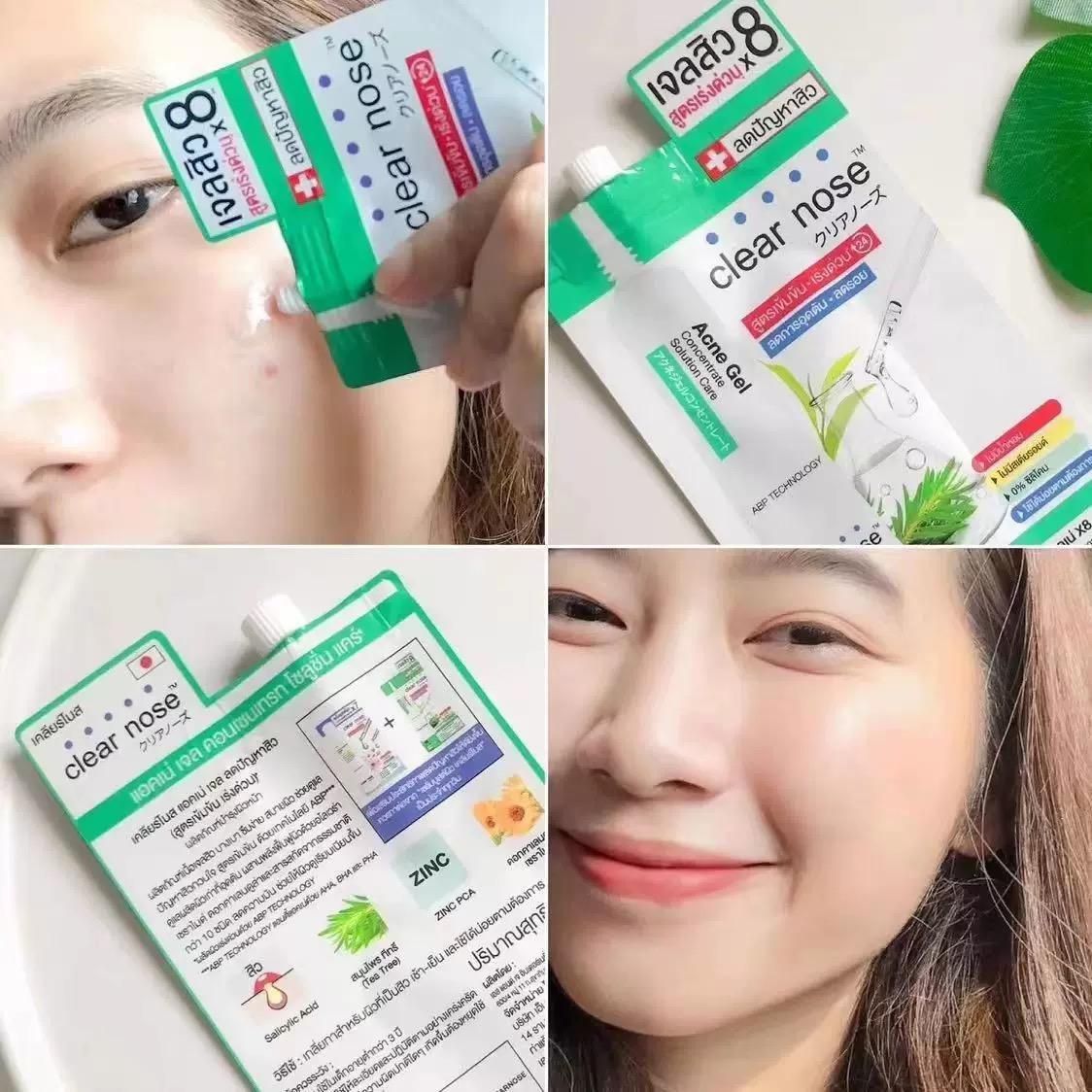 CLEAR NOSE Tea Tree Alcohol-Free Acne Gel Concentrate Solution 4g/15g