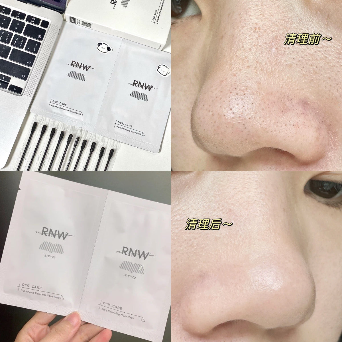 RNW Clear Nose Pack Blackhead Removal Pore Contraction 5sets