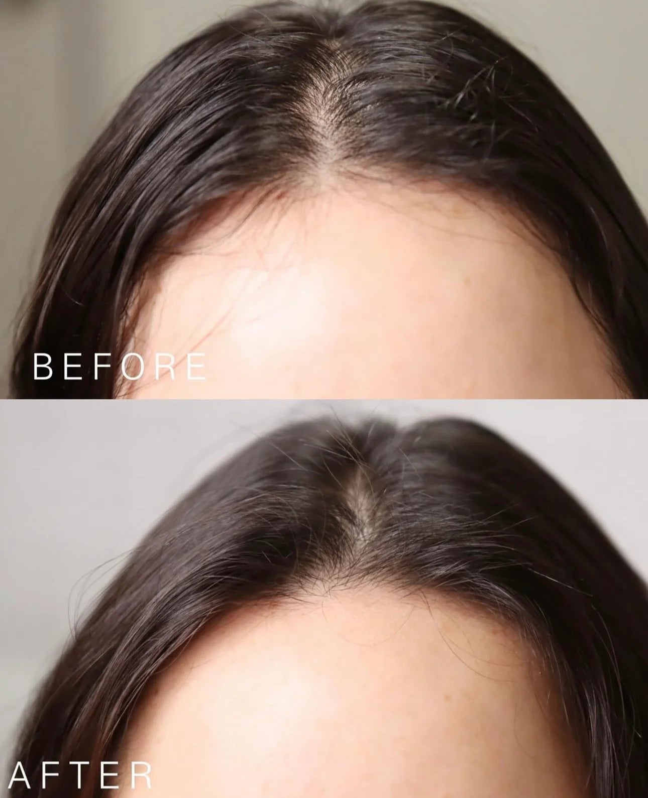 LABO-H Hair Loss Care Hair Line Ampoule 15ml