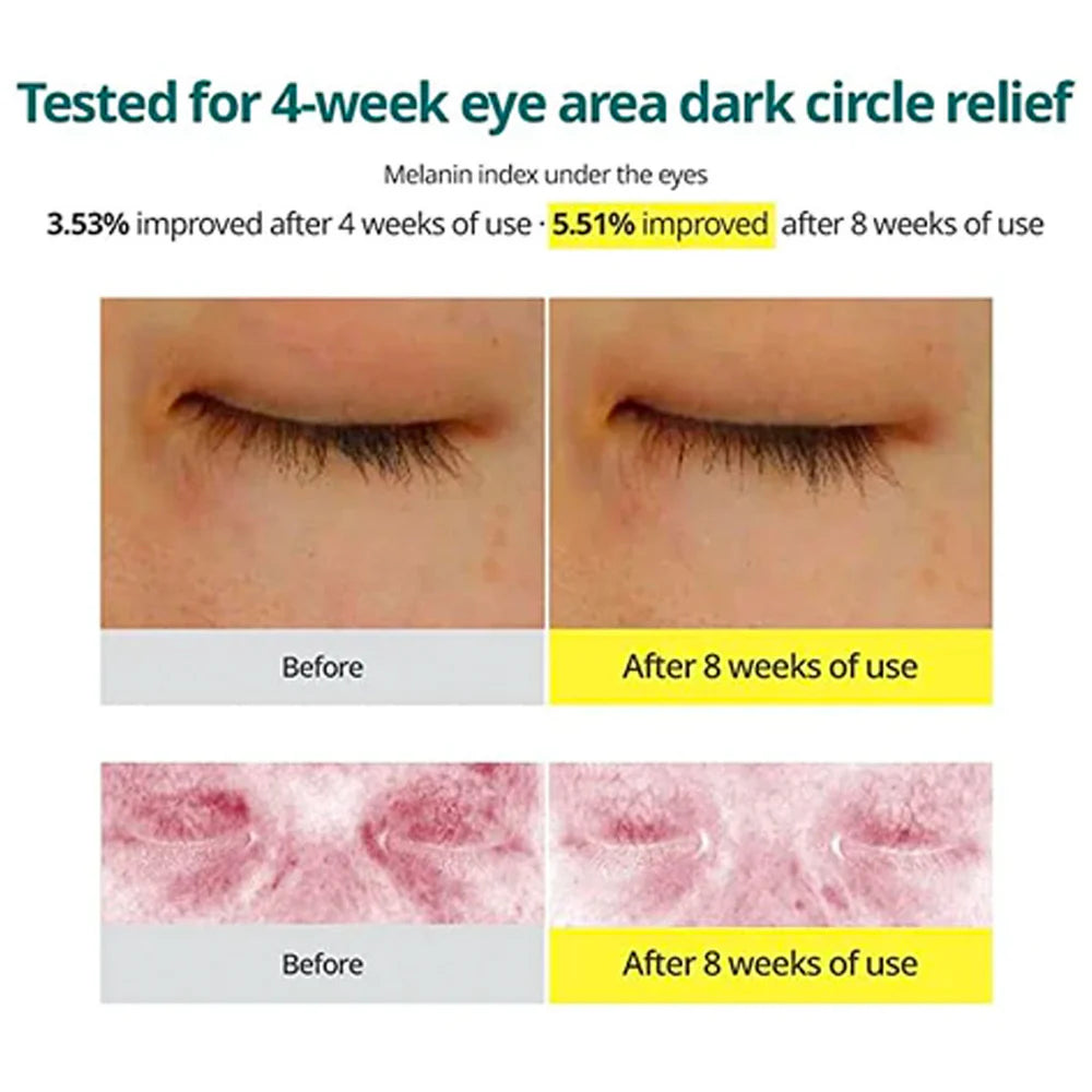 Goodal Green Tangerine Vita C Dark Circle Eye Cream 30ml