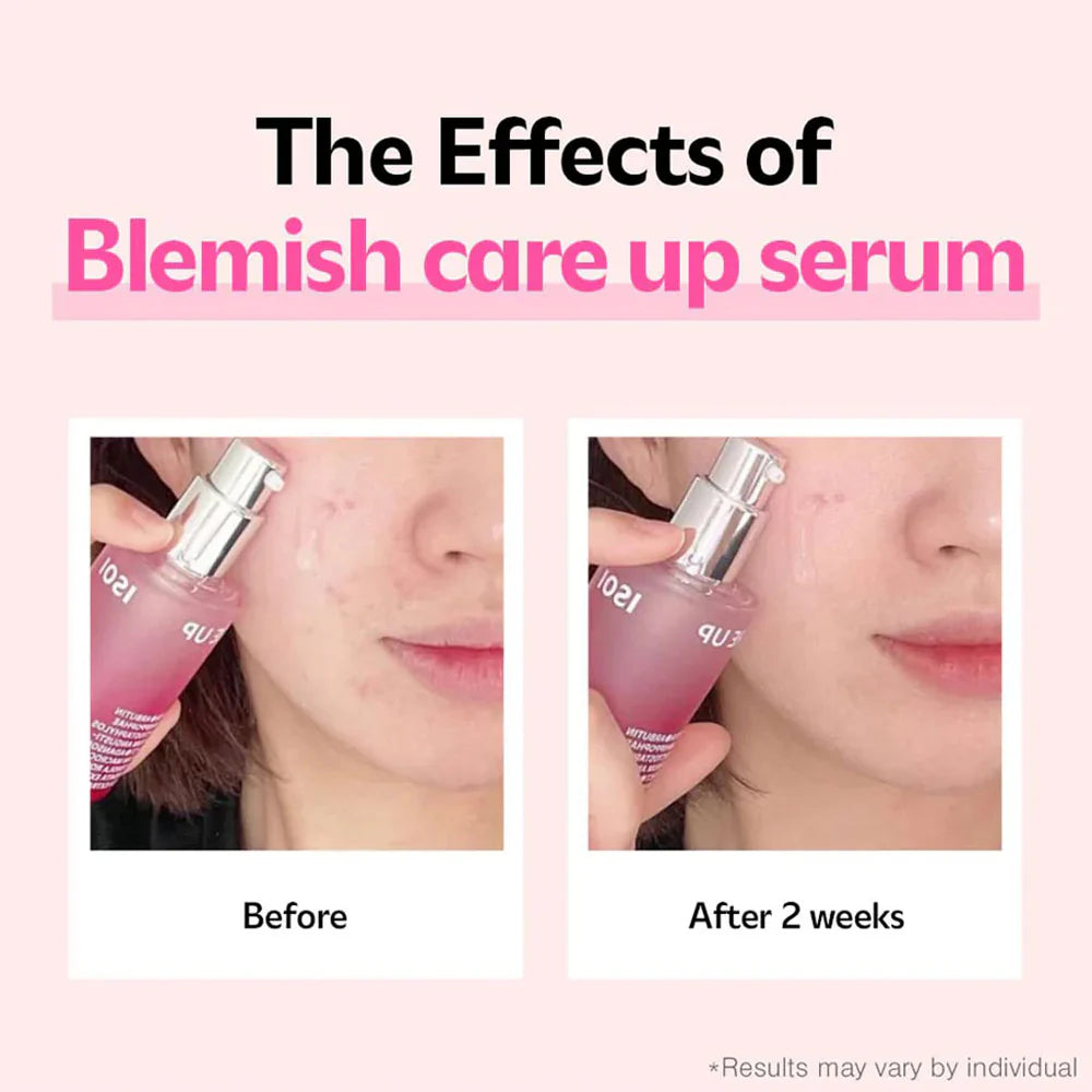 Isoi Blemish Care Up Serum 35ml