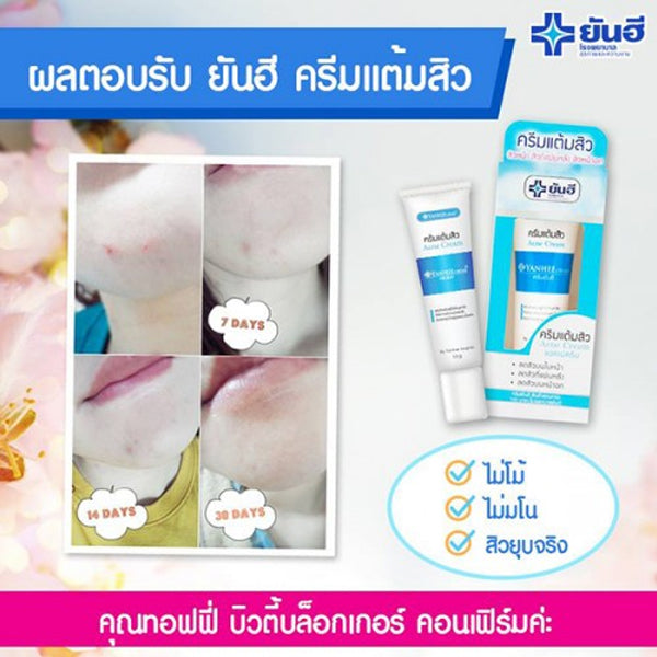 Yanhee 泰國 暗瘡袪痘膏 10g