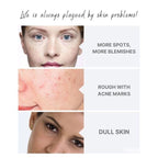 Dong-A Pharm Melanosa Cream (4% Hydroquinone for Melasma, Freckles & Dark Spots) 30g