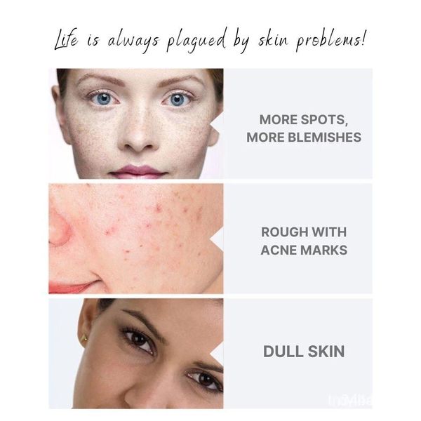 Dong-A Pharm Upgraded Version Melanosa Cream (4% Hydroquinone for Melasma, Freckles & Dark Spots) 30g