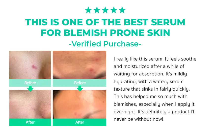 BRING GREEN Zinc Teca™ 1.2% Blemish Serum 25ml