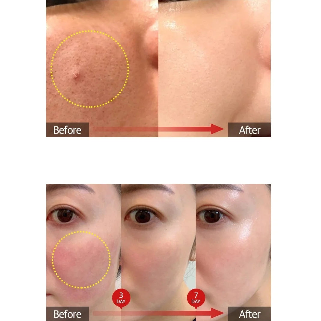 Medipeel Vegan Cica Nol Ampoule Mask 30ea