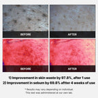 Medicube Red Succinic Acid Peeling Pad 70ea