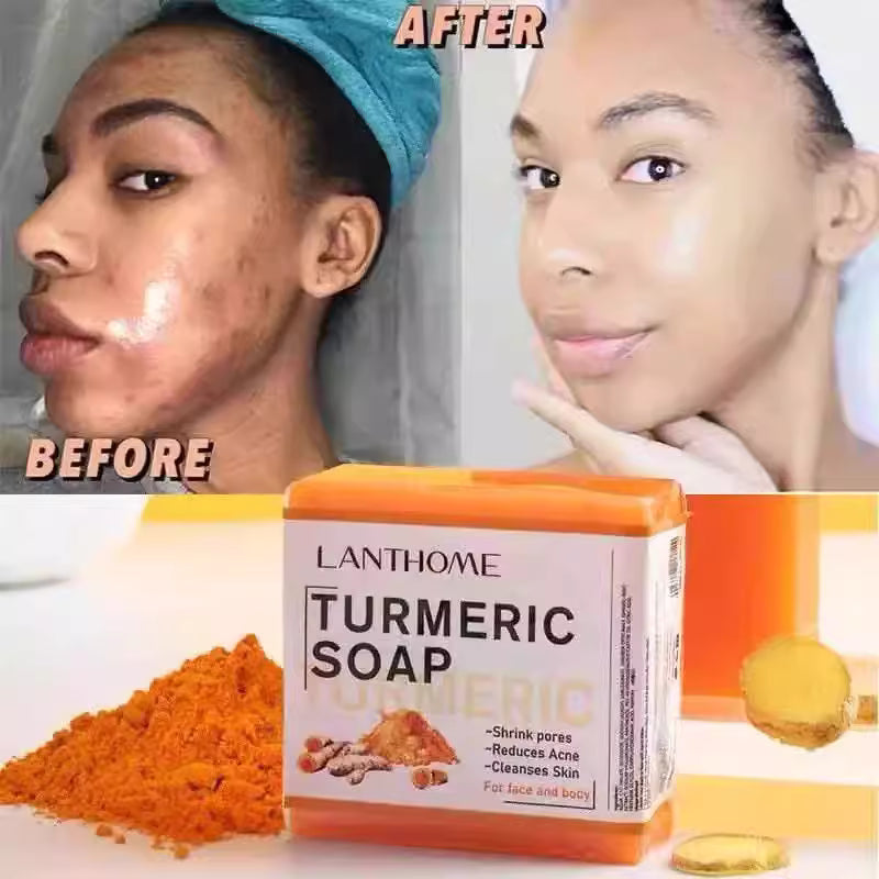 LANTHOME TURMERIC Remove Pimples Dark Spots SOAP 100g