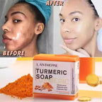 LANTHOME TURMERIC Remove Pimples Dark Spots SOAP 100g