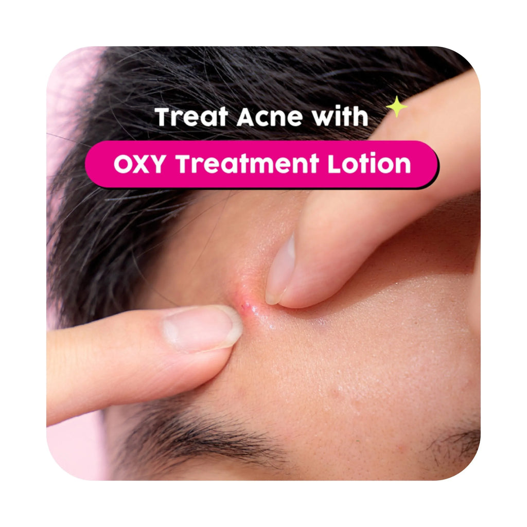 OXY 10 Benzoyl Peroxide Acne Gel (Yellow) 25g