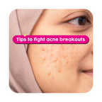 OXY 10 Benzoyl Peroxide Acne Gel (Yellow) 25g
