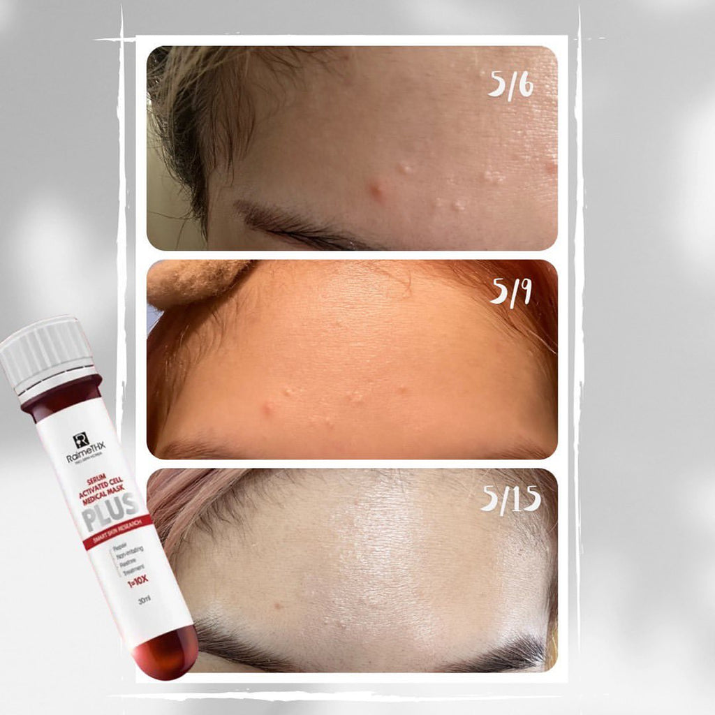 RaimeTHX Collagen Firming Elastic Moisturizing Mask 35ml x 5ea