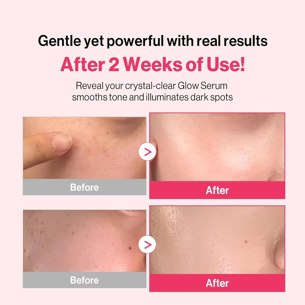 Re:dence Niacinamide Tone & Spot Perfect Glow Mask 25ml x 10