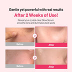 Re:dence Niacinamide Tone & Spot Perfect Glow Mask 25ml x 10