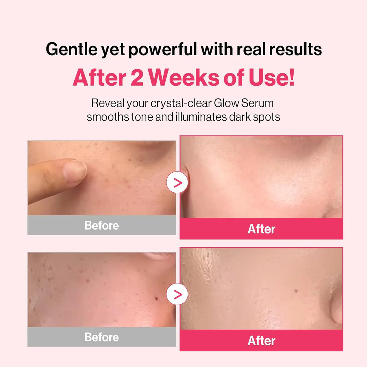 Re:dence Niacinamide Tone & Spot Perfect Glow Mask 25ml x 10