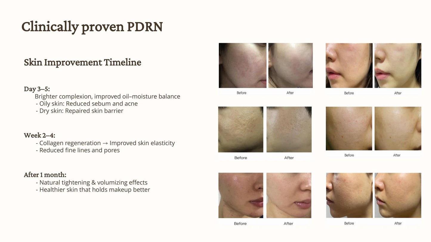 Rejuveon PDRN 1000 Plus Cream 20g