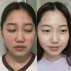 SOME BY MI AHA BHA PHA 30 Days Miracle Serum 50ml