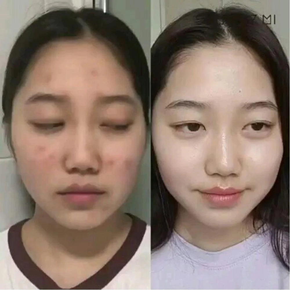 SOME BY MI AHA BHA PHA 30 Days Miracle Serum 50ml