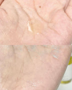 Ample N Acne Shot Ampoule 30ml