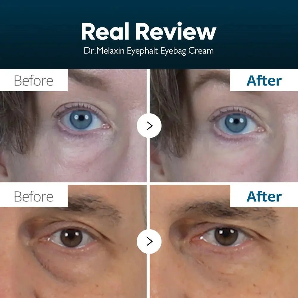 Dr.Melaxin Eyephalt Eye Cream for Eyebag Anti-Wrinkle Night Cream (Help to Reduce Under Eye Wrinkle) 10ml