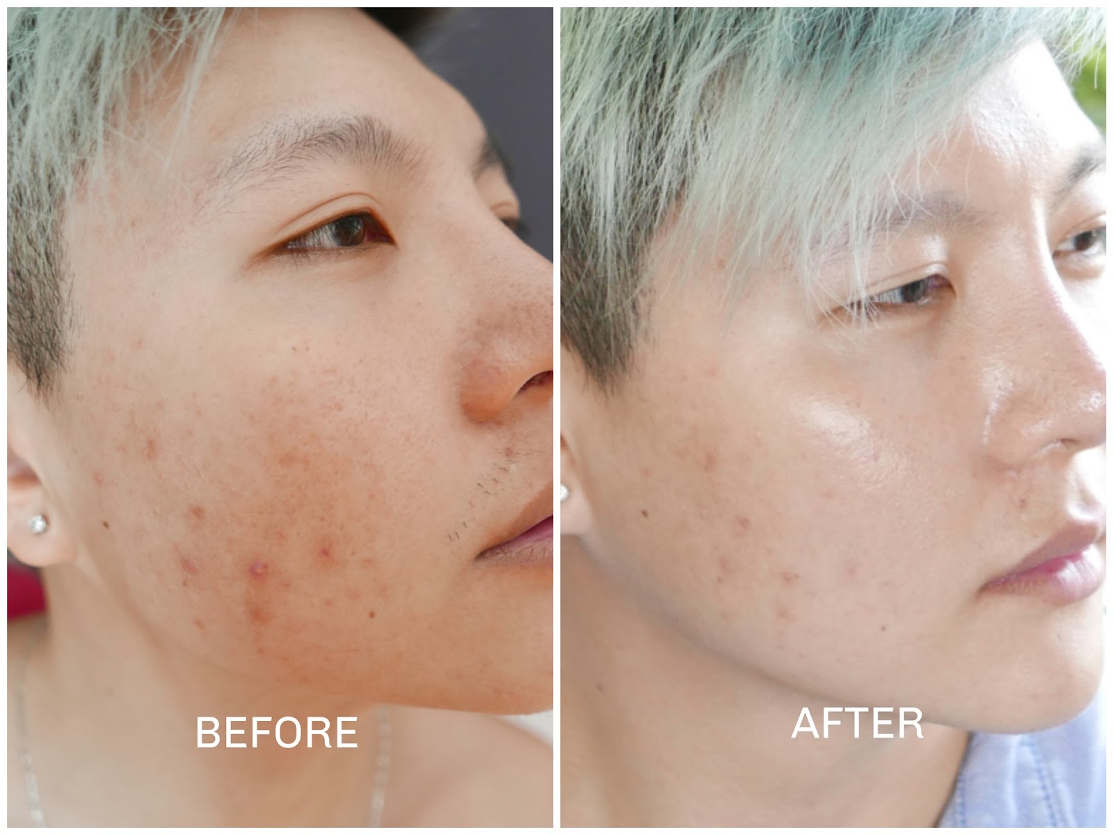 Yanhee Anti-Wrinkle Mela Cream 20g