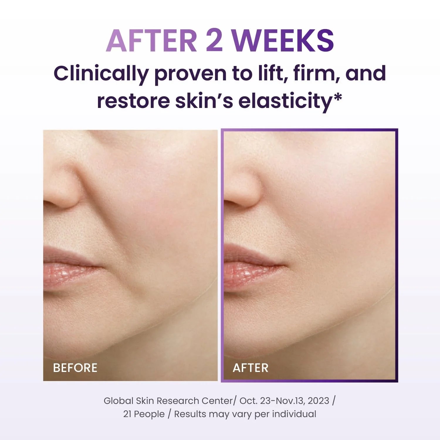 BOH Probioderm 3D Lifting Ampoule 30ml