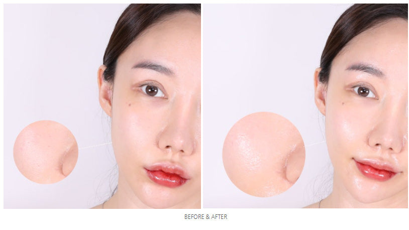 Mediheal Vegan Essential Mask Set (Total 6 boxes)