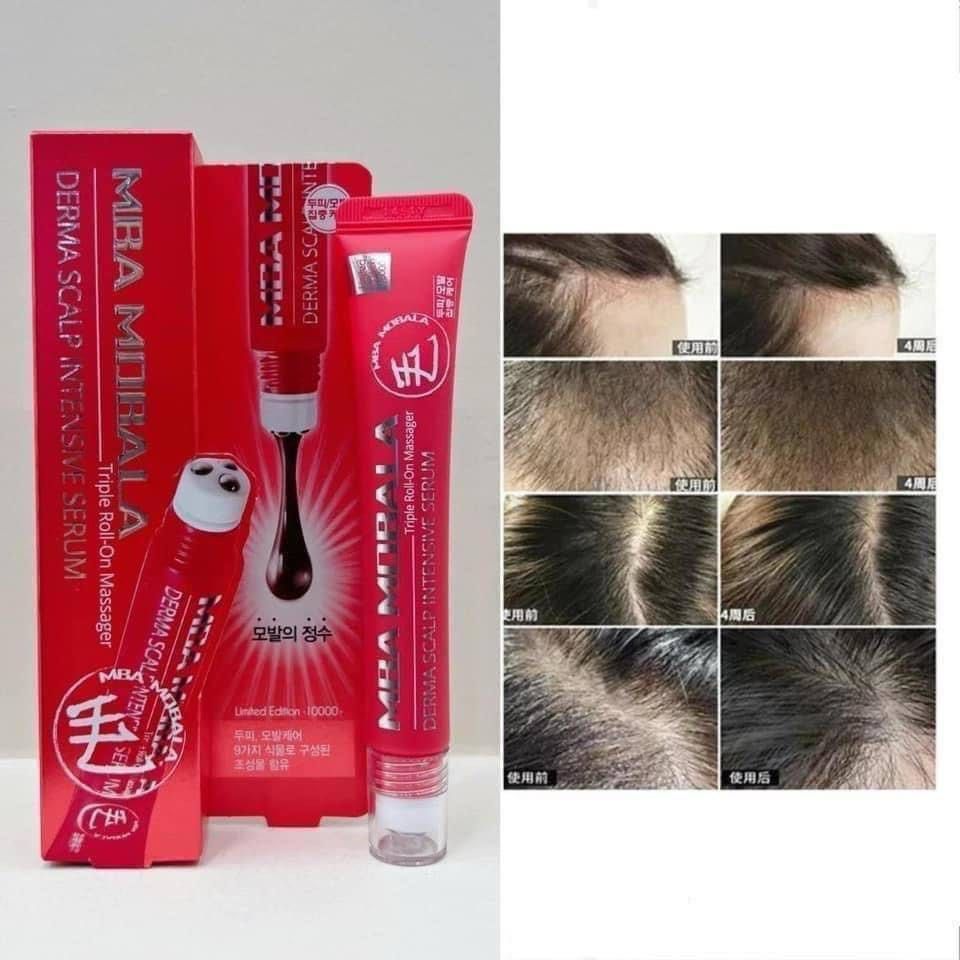 DAYCELL Derma Scalp Intensive Triple Roll-on Massager Serum (Red Limited Edition) 20ml