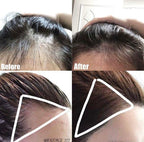 DAYCELL Derma Scalp Intensive Triple Roll-on Massager Serum (Red Limited Edition) 20ml