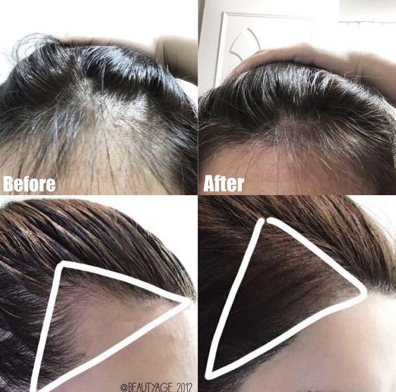 DAYCELL Derma Scalp Intensive Triple Roll-on Massager Serum (Red Limited Edition) 20ml