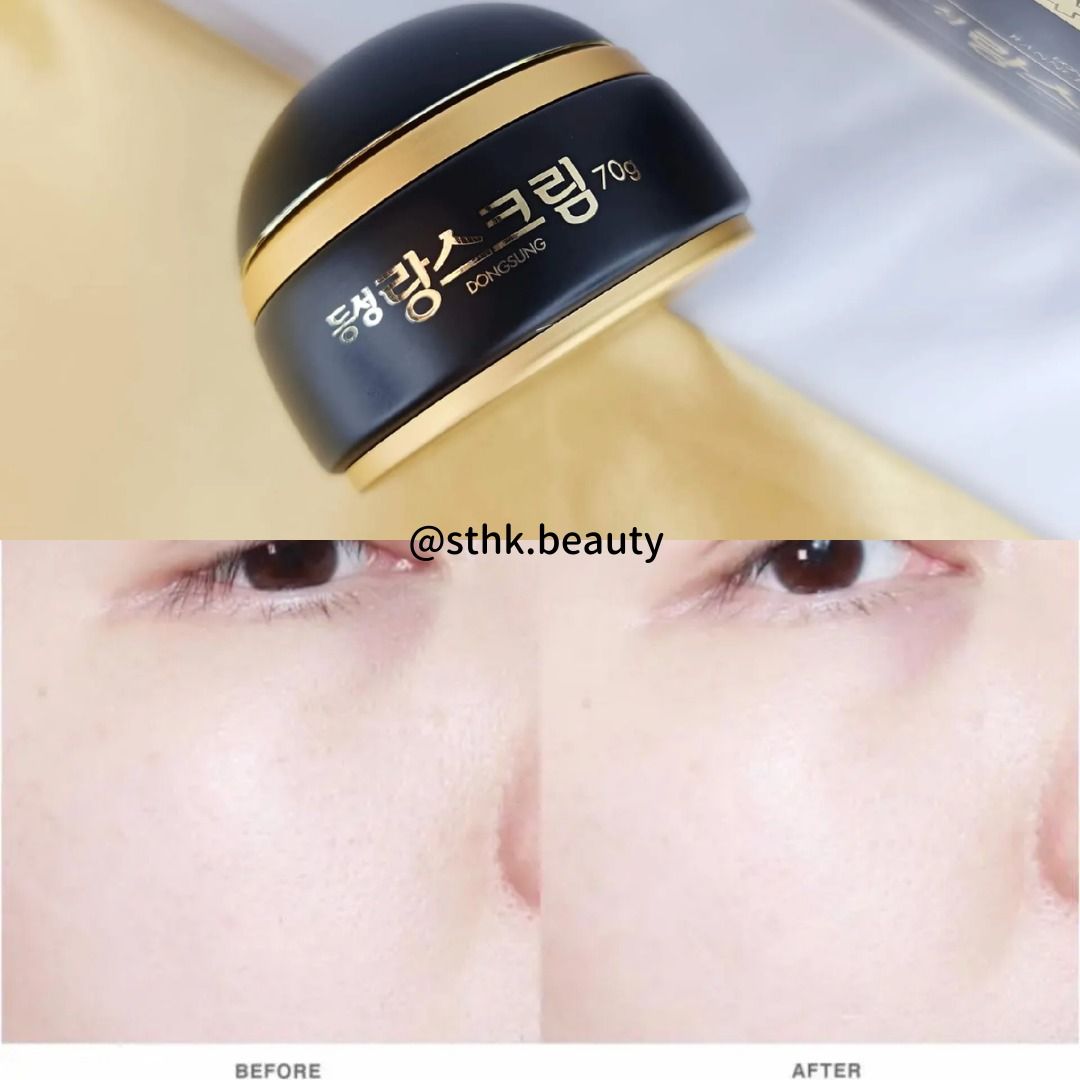 DongSung Pharmaceutical Rannce Cream 70g