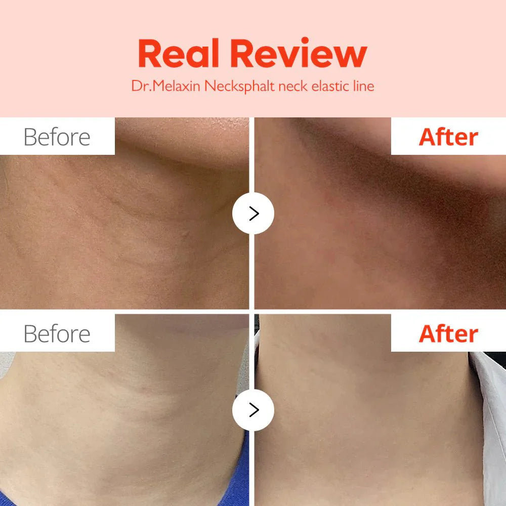 Dr. Melaxin 韓國 Necklinephalt 瞬間緊緻頸霜 20ml