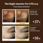 Dr. Reju-All EP4 Advanced Retino-Mela Tone Cream 30ml