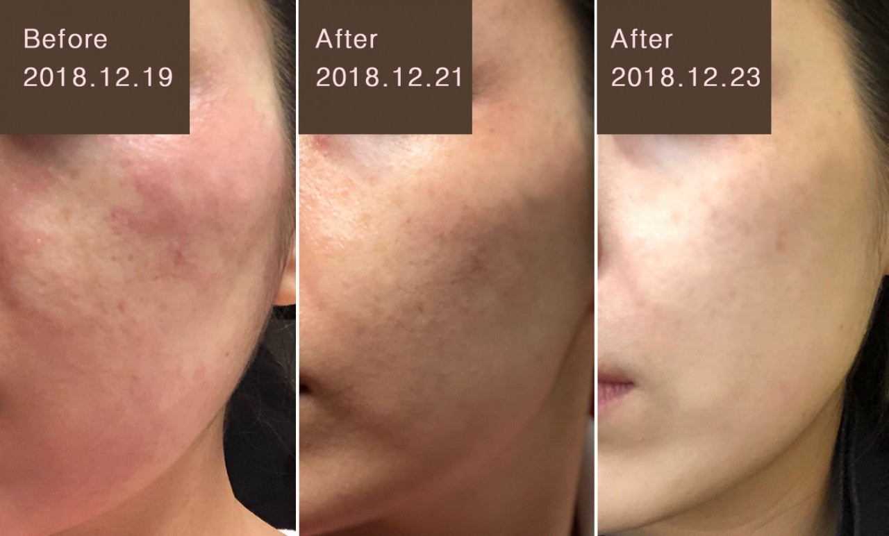 Barusol Expert Repair Salve Cream 30ml