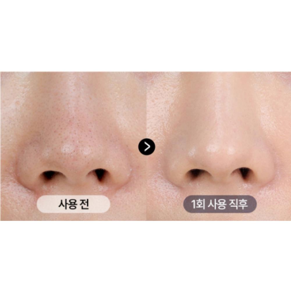 Medipeel Extra Super 9 Plus 2.0 (Upgraded Version) 1000ml