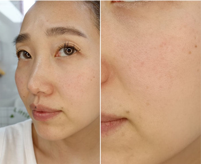 Hanmi Pro-Calm EGF PDRN Active Synergy Mask 5 packs / box