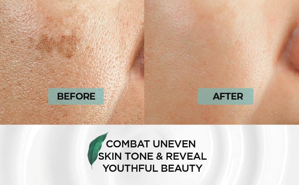 TG Dominas Whitening Cream RX (Freckles Care & Blemish Care) 50g